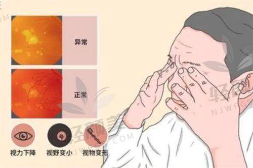 【甘谷县人民医院眼科医生名单】