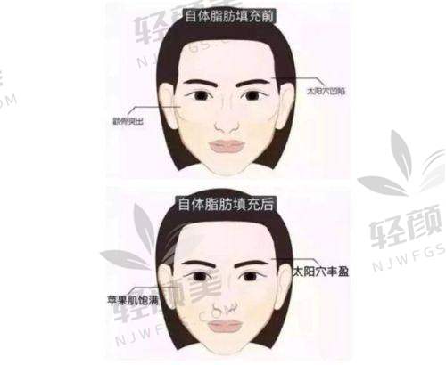 【兰州仁和医疗美容医院怎么预约挂号】