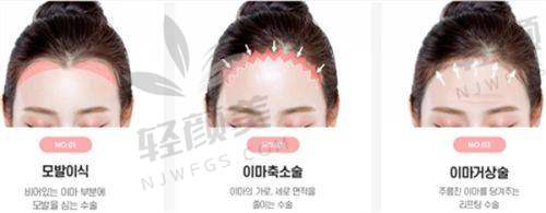 【兰州华美医疗美容医院医生名单】