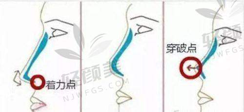 【兰州梦怡美医疗美容诊所电话号码是多少】