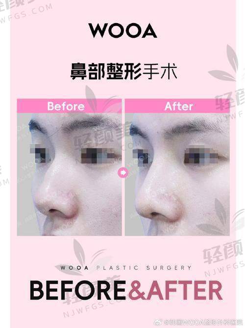 手术前的紧张与期待