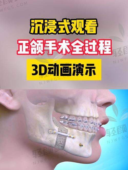 一、2026偏颌手术报价太真实，看完后哭了，是真的疼钱包