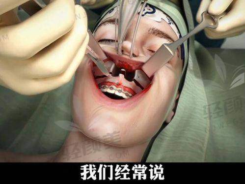 四、【上海偏颌手术总价逼近20W？医院套路大起底】