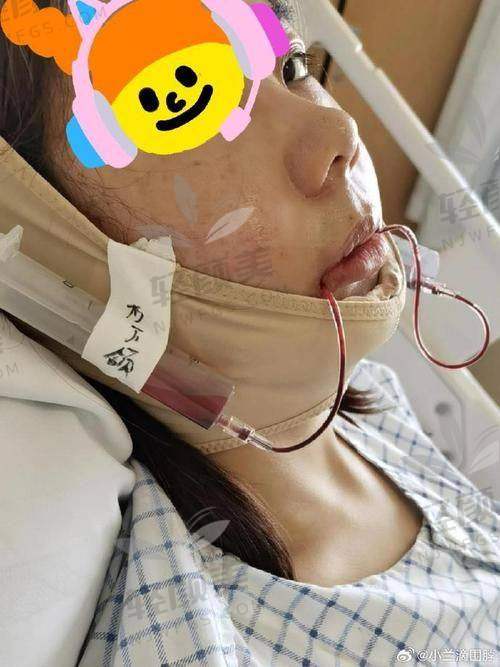 五、别忽略“术前正畸费用”！偏颌整牙才正颌，别玩反了顺序