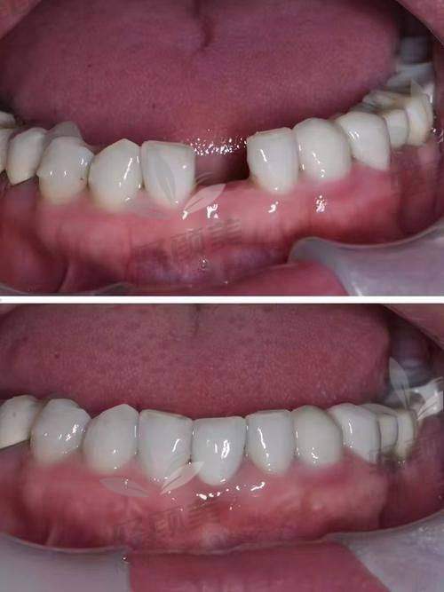 一、初到北京维乐口腔