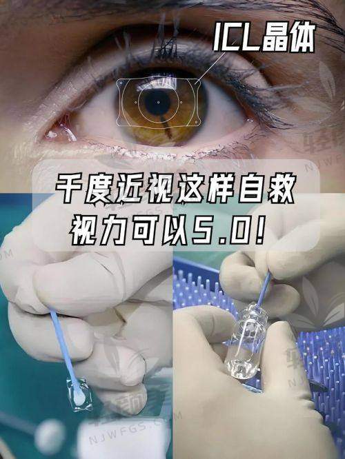 MF15优点大起底: