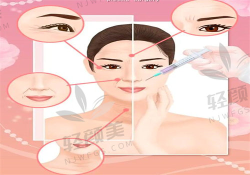珀利肤宝宝针是长效水光吗？揭秘其黑科技配方与 6 - 12 个月长效美肤秘诀！