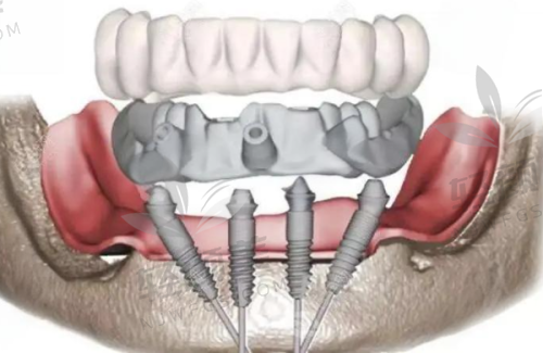 详细检查与方案制定