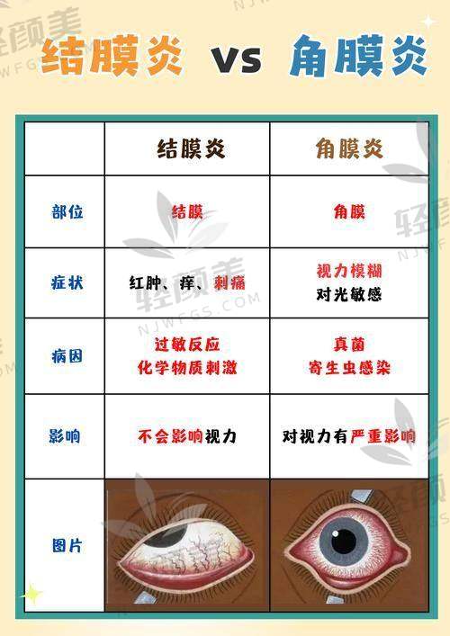 四、谁适合去华厦做晶体植入?哪些人一定要去?