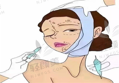 速看！伊婉 C 玻尿酸是大分还是小分，关乎填充维持时间和塑形效果