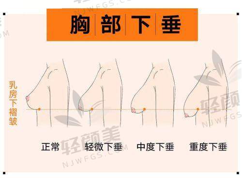 预约挂号方式