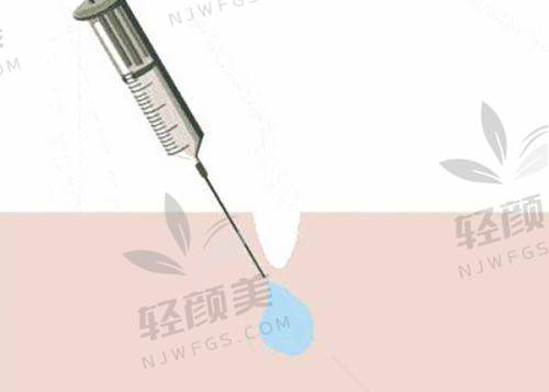 乌鲁木齐华美郭玲玲做第五代黄金微针7200元起,精准焕肤效果优