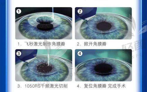 【平凉市人民医院眼科仪器设备有哪些】