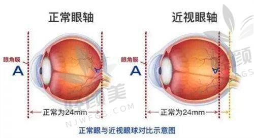 【张掖市人民医院眼科怎么预约挂号】