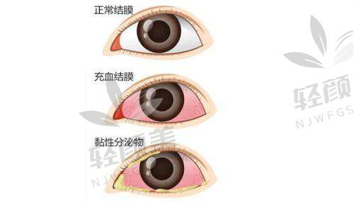 【武威市人民医院眼科仪器设备有哪些】