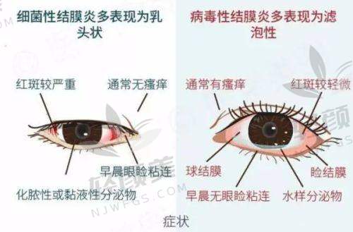 【张掖市第二人民医院眼科擅长什么项目】