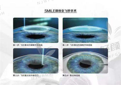 【张掖市第二人民医院眼科营业时间是什么时候】