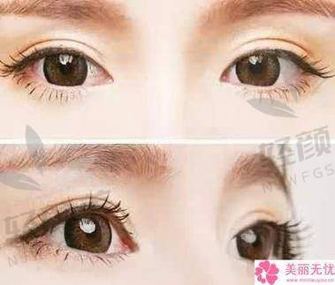 一、哈尔滨瑞丽整形2026年价目表曝光，自体脂肪隆鼻、吸脂塑形价格大起底！