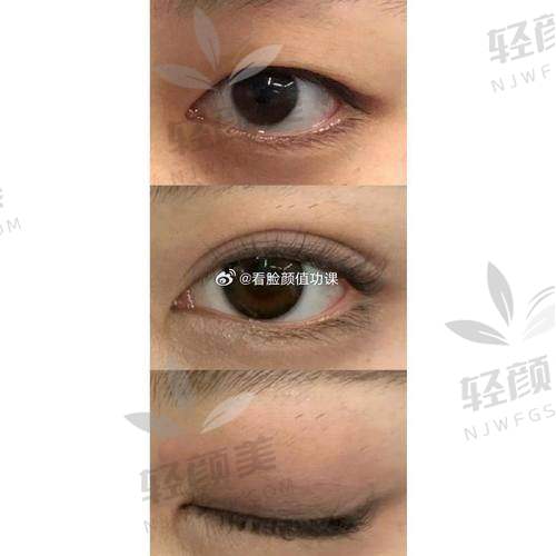 五、价格背后的秘密：哈尔滨整形圈的避坑指南