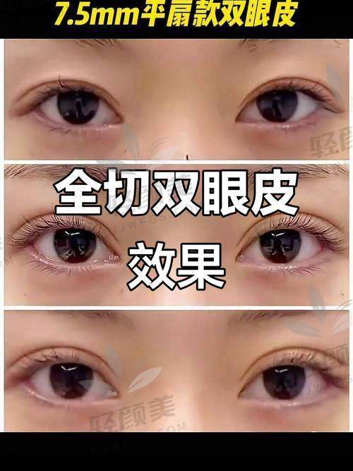 二、面部整形项目&价格通透表（双眼皮、隆鼻命中率MAX）