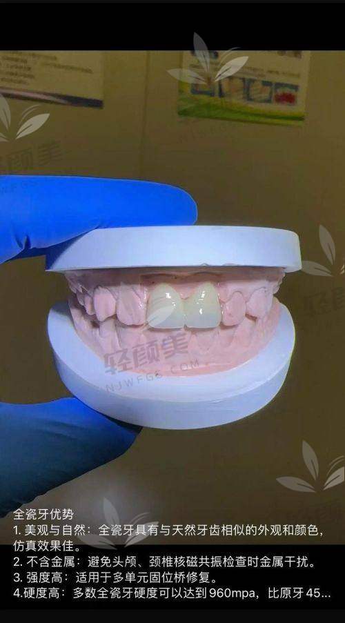 术后感受和推荐