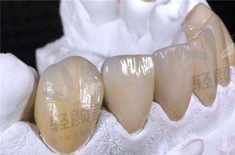 价格大揭秘:3500元值不值?