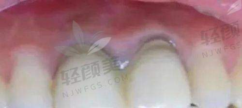治疗过程:轻松又有趣