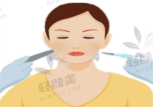 伊婉玻尿酸分型号吗？一篇文章带你了解 C 型和 V 型的区别与选择