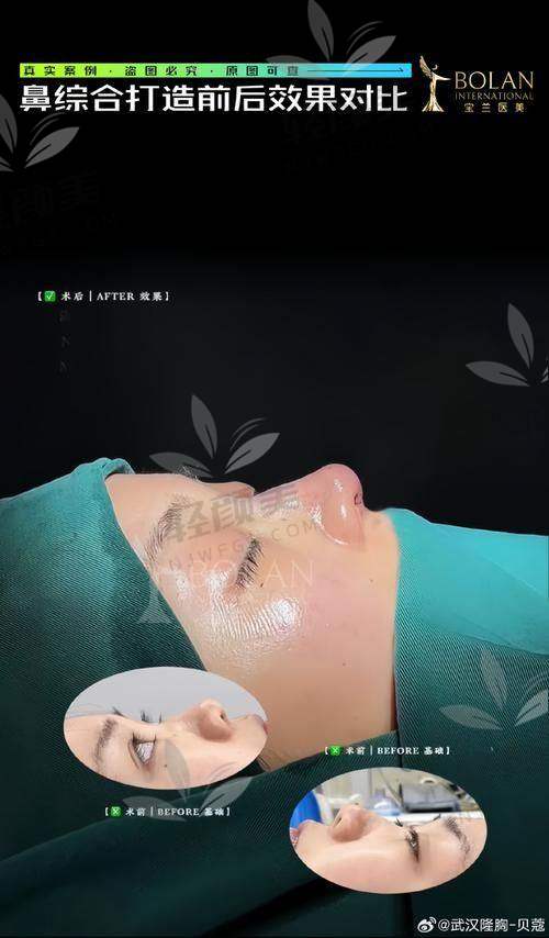 如何预约崔娟医生?