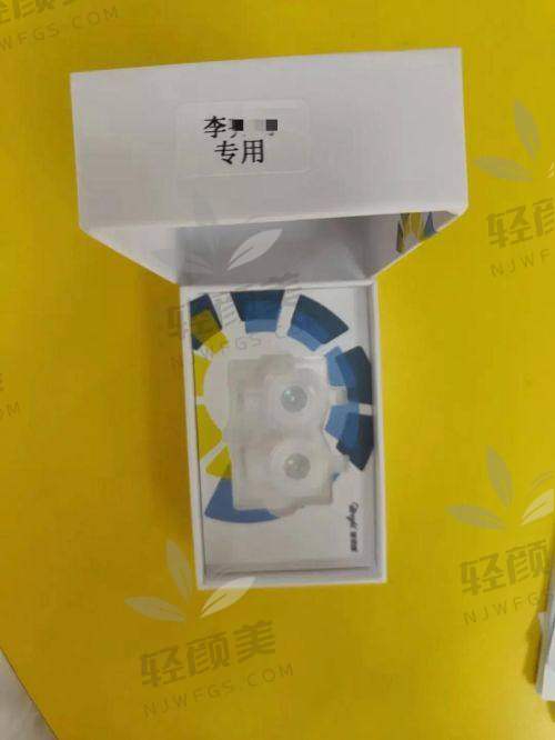 “配个OK镜怎么比做双眼皮还复杂?”——全流程拆解新视界OK镜收费套路