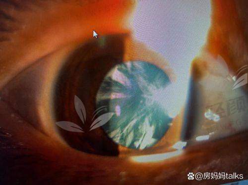 如何预约白莹医生挂号?