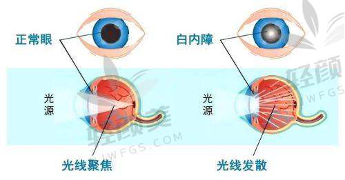 宋晓珍医生技术特点