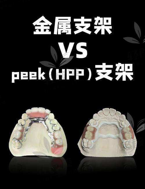 怎么防止在镶牙这件事上被套路?价格项目清单建议这样比
