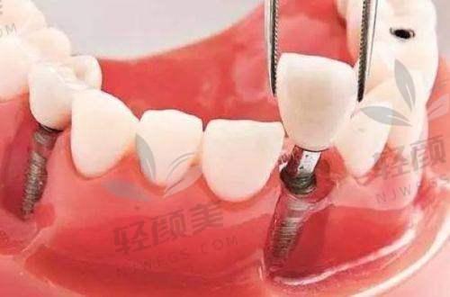 与王旭医生的面诊