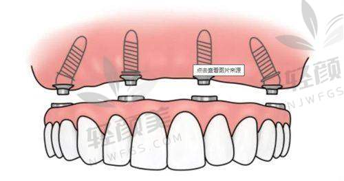 【吴忠牙卫士口腔门诊部技术特点】