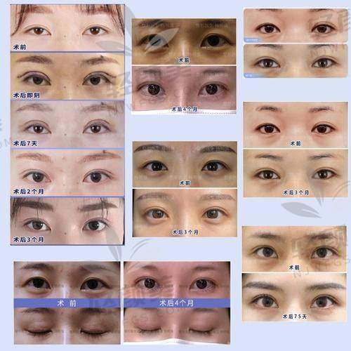 一、沈阳杏林美容院整形医院价格表曝光，别再做“糊涂账”啦！