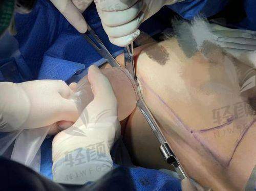 广州 · 美恩整形医院2026报价明细