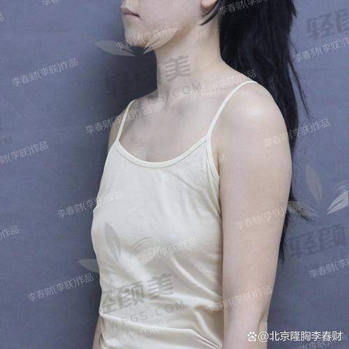 韩国 · THE医院、profile整形2026年国内外价格价目表