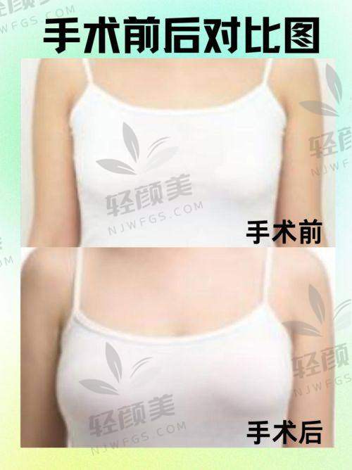 北京 · 联合丽格&杏林整形2026魔滴假体隆胸价格表