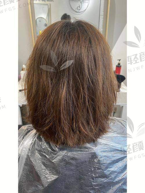 【兰州碧莲盛植发医院是正规的吗】