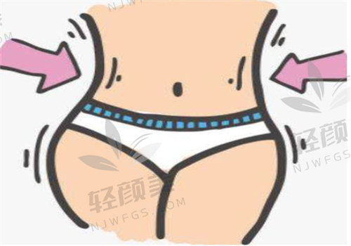 花19800元找新疆威兹曼王丽君做腰腹环吸，术后效果惊艳，这价格太值了！