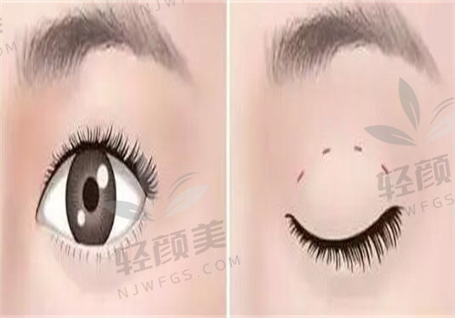 想了解长沙美莱医疗美容医院收费价格表？整形、皮肤、玻尿酸项目价格大揭秘！