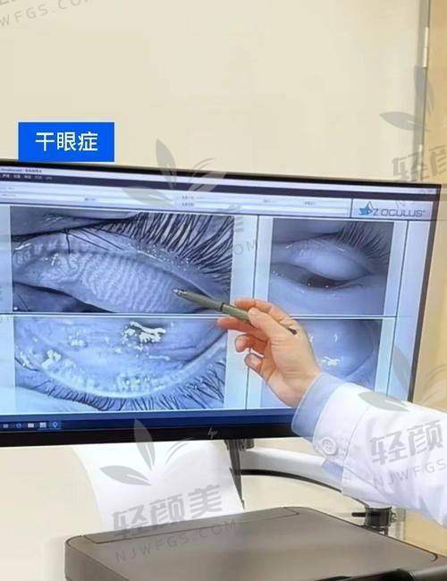 六、shock!华厦眼科擅长的干眼细分项目价格也太“人性化”了!