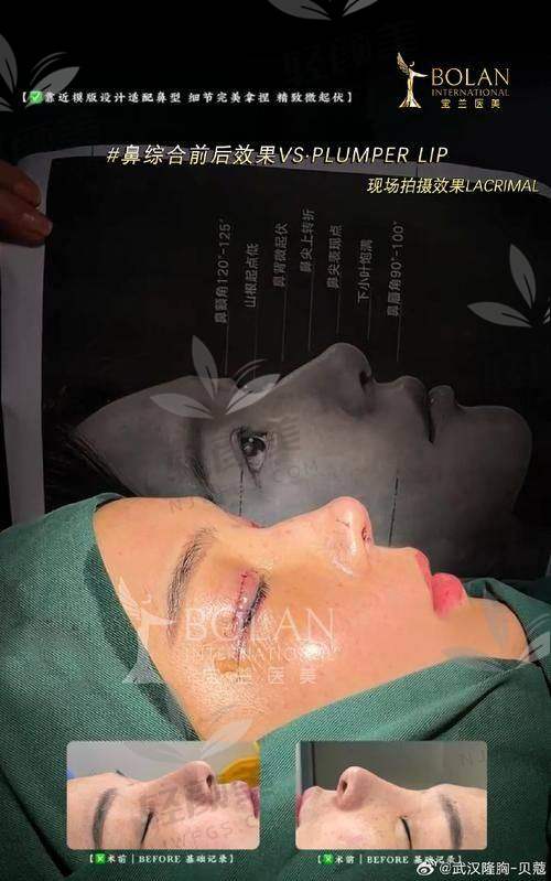 下定决心踏上变得更美之路