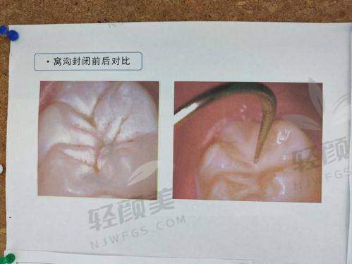 术后回访，贴心服务暖人心