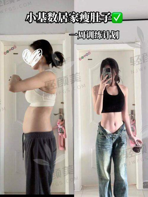 用户对新疆威兹曼王丽君医生做腰腹环吸的口碑