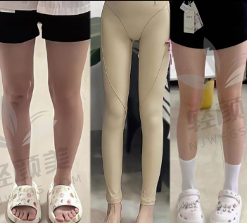 三、关于医生和技术团队,谁在操刀特别重要