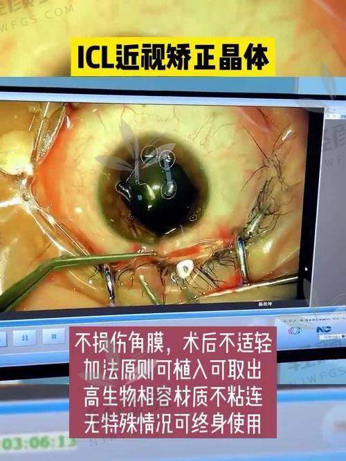 二、价格区别有多大?贵那怕不是加了盲盒吧?