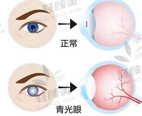 七、看完再决定!避免“价格当侦探”的尴尬