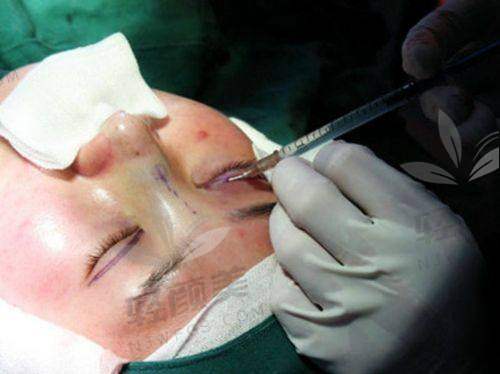 冯建业怎么预约挂号？